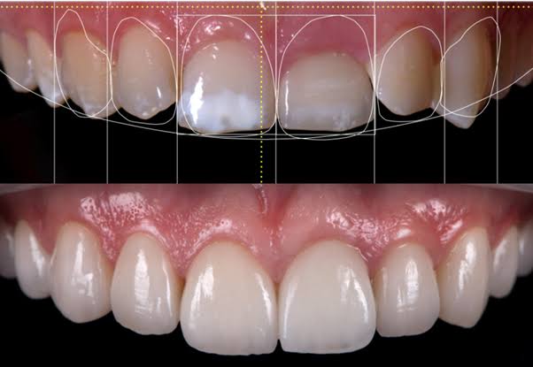 At Paras Dental Care, we believe that a beautif... main image