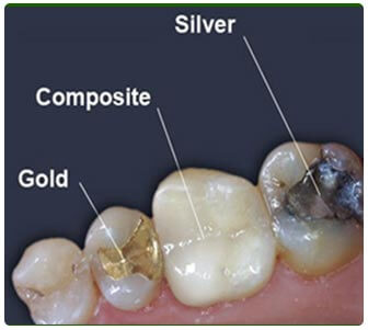 Best Dentist in Kalwa 
Best Dentist in Thane East ... main image