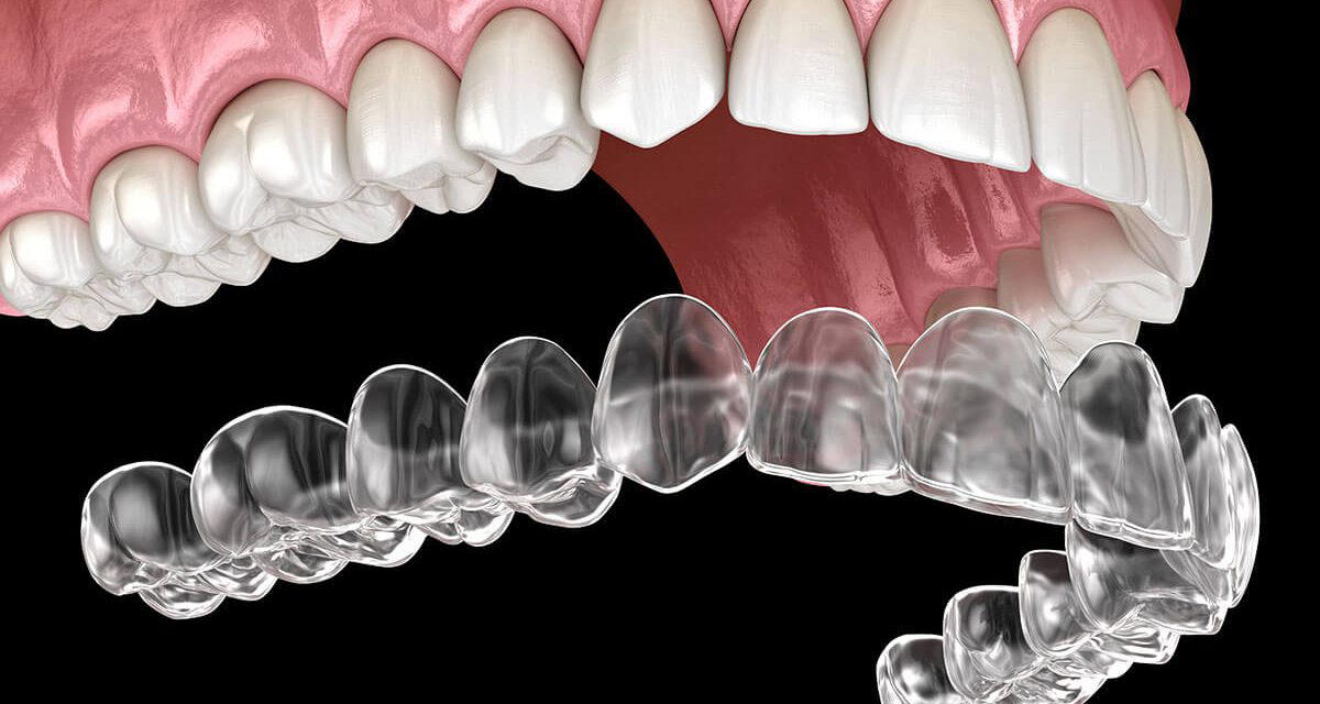 Best Dentist in Mumbra
Best Dentist in Diva
Be... main image