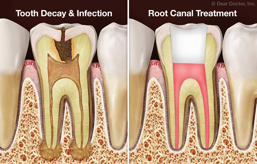 Top Dentist in Kharegoan Kalwa, Mumbai 
Best De... main image