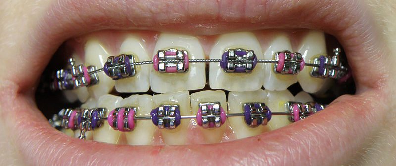 Best Dental Implement Clinic in Kalwa 
Best Den... main image