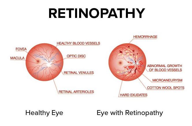 Retinopathy Treatment at Green City Eye Clinic,... main image
