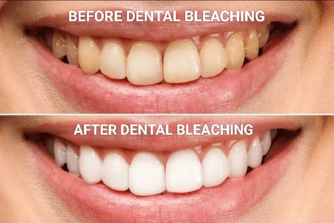 At Paras  Dental Care, we bring you The Magic o... main image