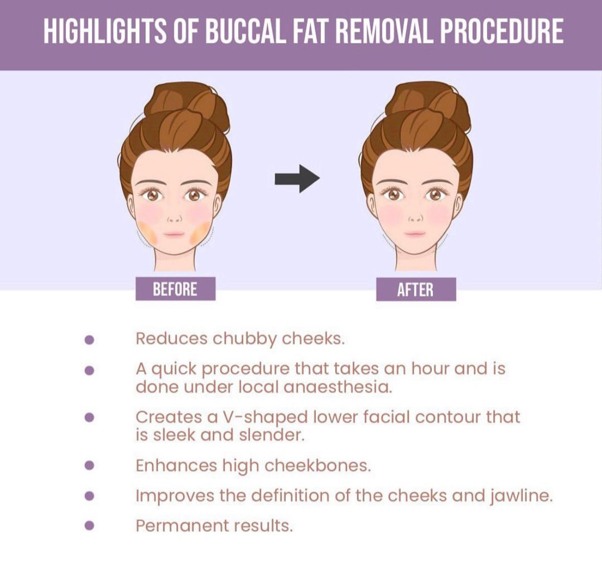 Buccal Fat Removal: Sculpt Your Face for a Sleek, ... main image