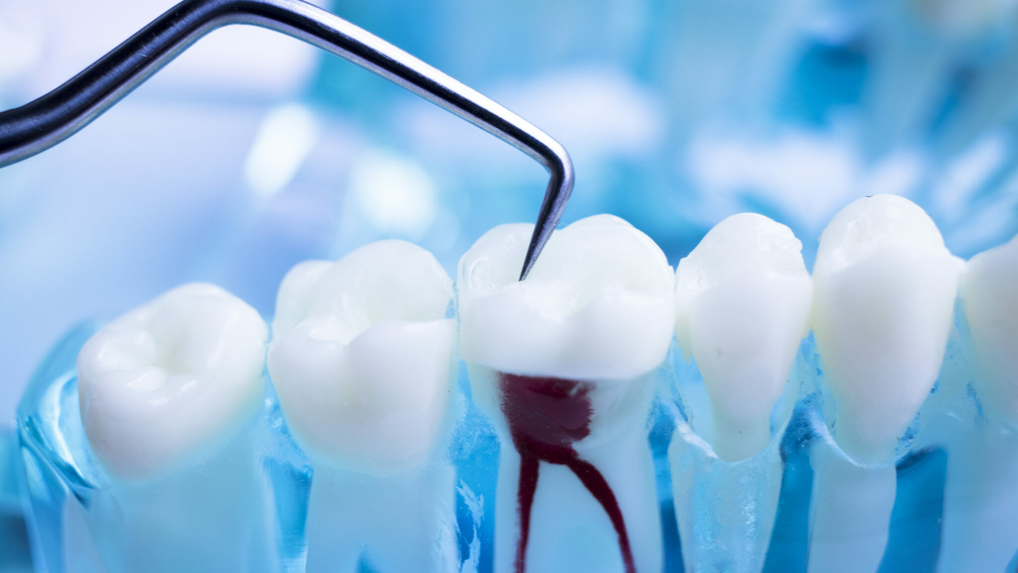 Best Root Canal Doctors in Kalwa-Thane, Mumbai
... main image