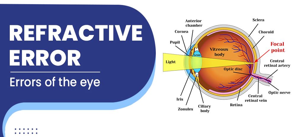 Refractive Error Correction at Green City Eye C... main image
