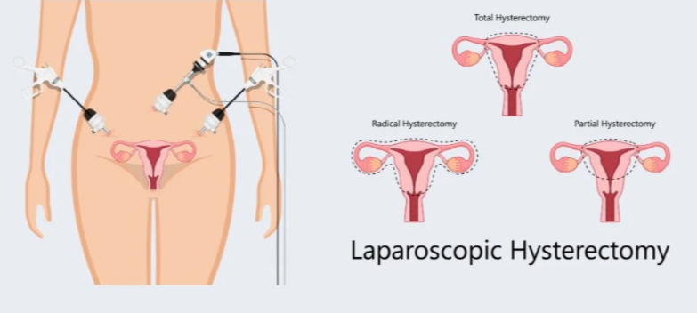 Laparoscopic and Hysteroscopic Surgical Centre ... main image