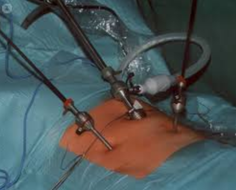 Dr. Bineet - Expert in Minimally Invasive Surge... main image