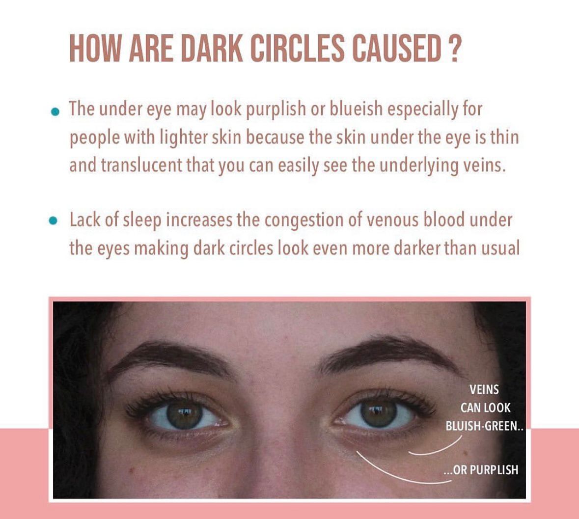 Understanding Dark Circles: Causes and Reasons Exp... main image