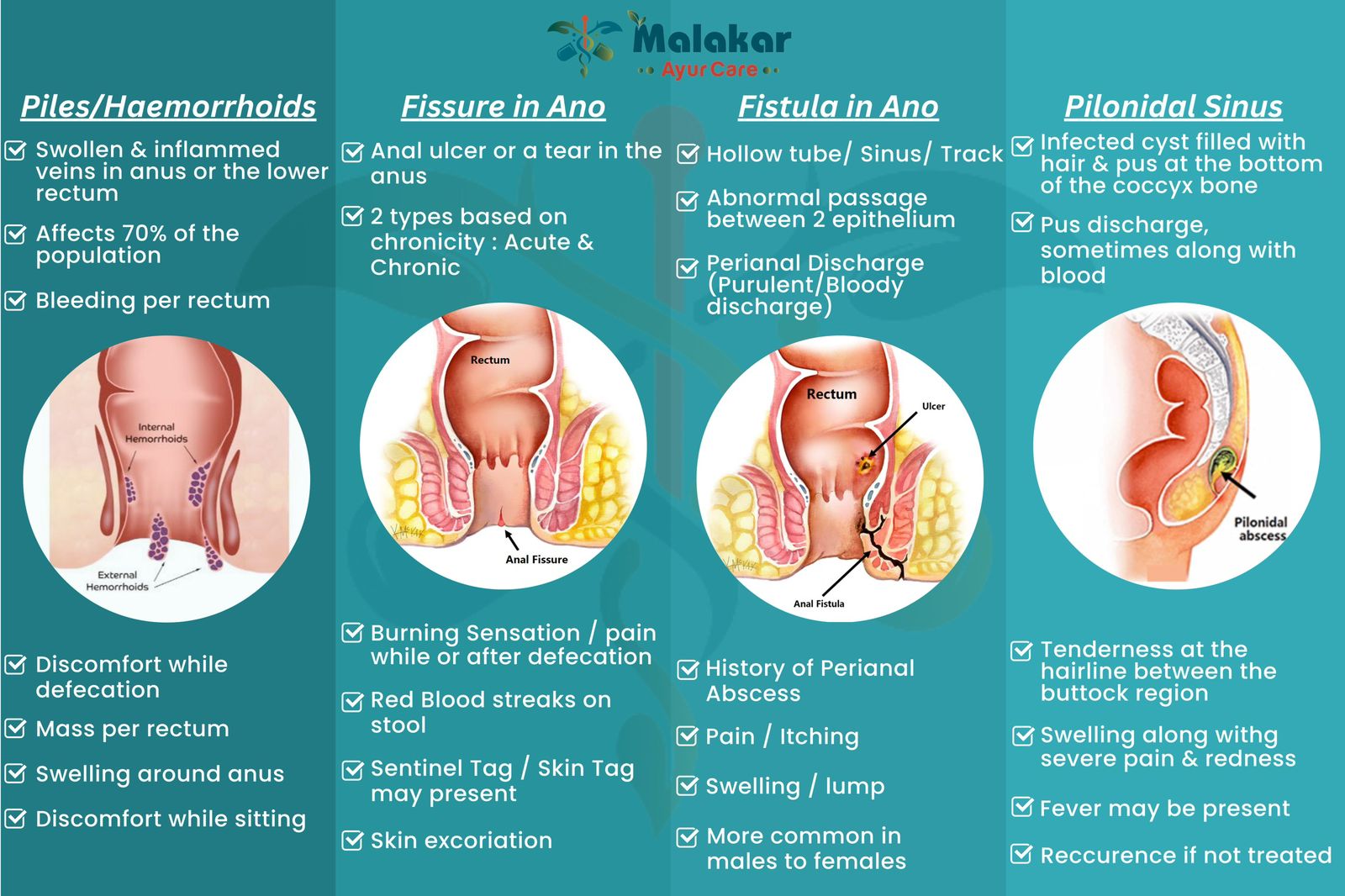 fissure specialist in woriyur
Malakar Ayur Care (M... main image