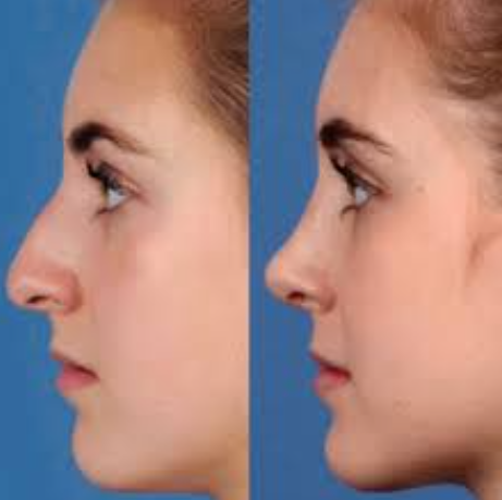 Expert Plastic Surgery in Rajkot at Vedant Hosp... main image