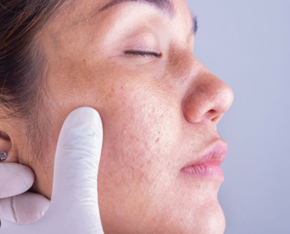 Skin Specialist Services in Bishop Garden Top Skin... main image