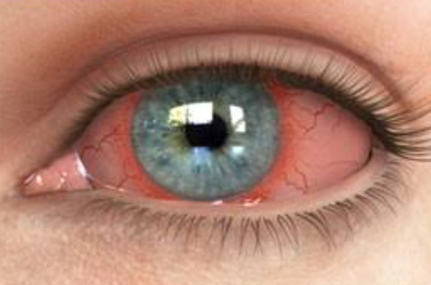 Damaged Retina Treatment at ISHA NETRALAYA Expe... main image