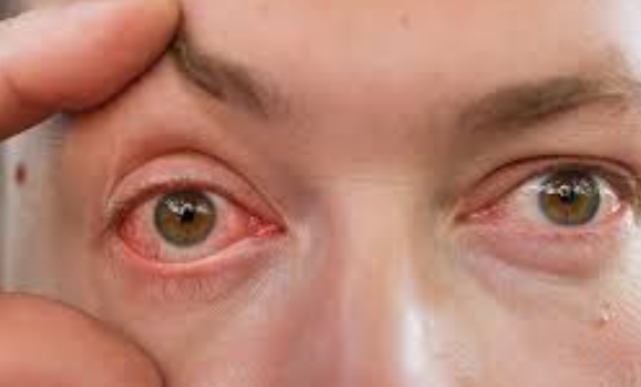 Swelling in Retina Treatment in Thane Effective... main image