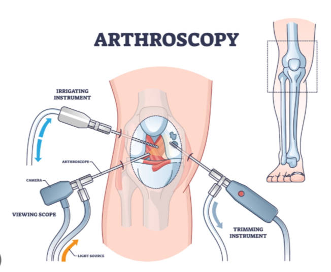 Arthroscopy Services at KC Hospital in Avadi Sp... main image