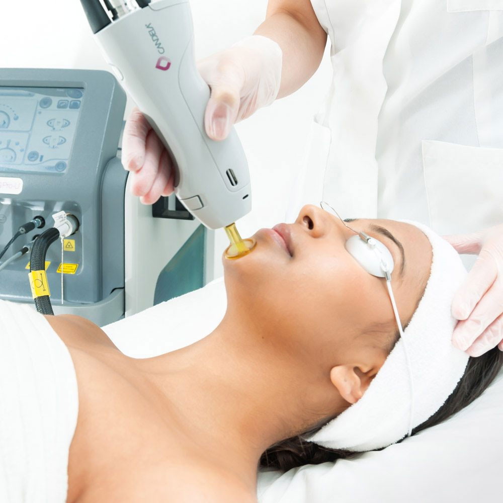 LASER HAIR REMOVAL AT VADAPALANI @ ELORAA The Gent... main image