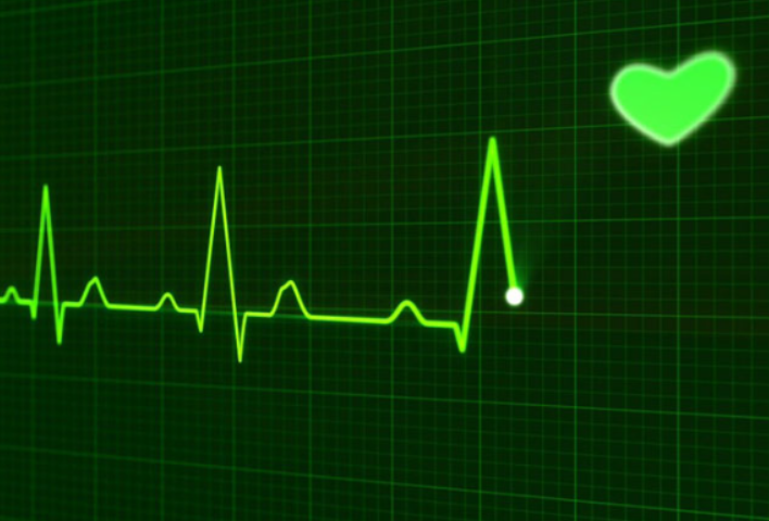 ECG (Electrocardiogr