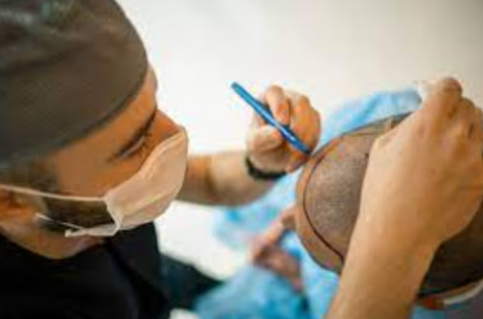 Find Top Hair Transplant Clinics Near You Best ... main image