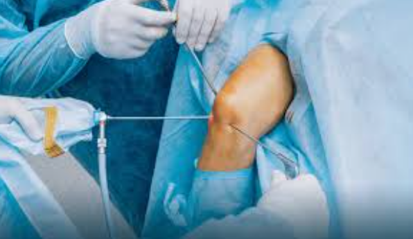 Arthroscopy and Sports Medicine at Welton Hospi... main image