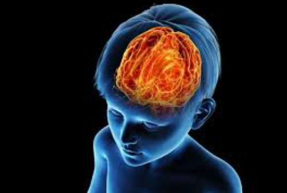 Pediatric Neurosurgery in Mumbai Pediatric Neur... main image