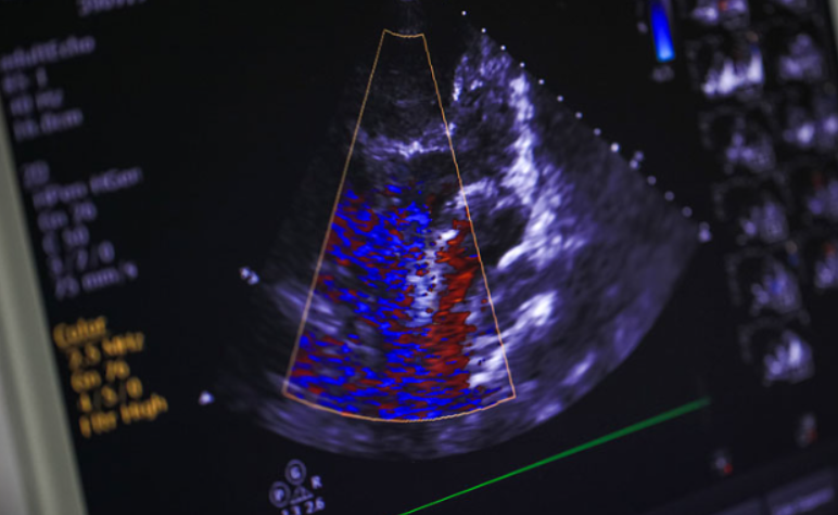 Echocardiogram at Vivekanand Arogya Kendra, Gur... main image