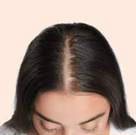 Revitalize Your Look with Hair Restoration at Elor... main image
