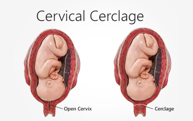 Advanced Cervical Cerclage Services at Green City ... main image