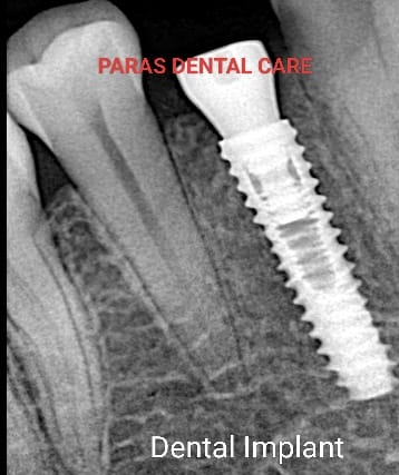 🦷 Discover Paras Dental care : Your Destination fo... main image