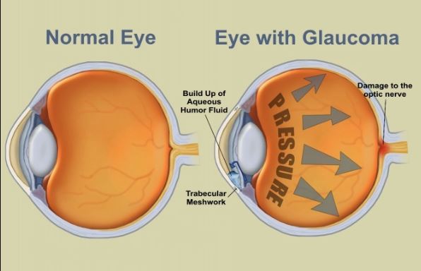 Leading Glaucoma Solutions at Green City Eye Cl... main image