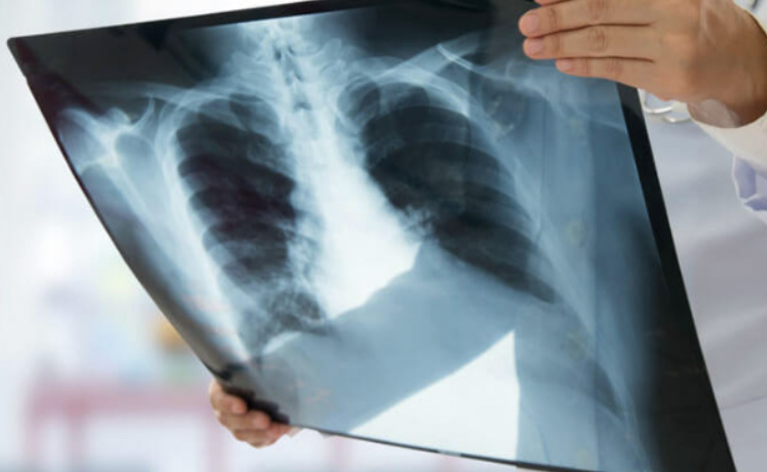 Digital X-Ray at Vivekanand Arogya Kendra, Gurugra... main image