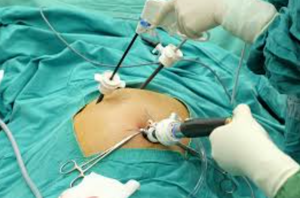 Best Gall Bladder Surgeon in Mumbai – Dr. Rajiv... main image