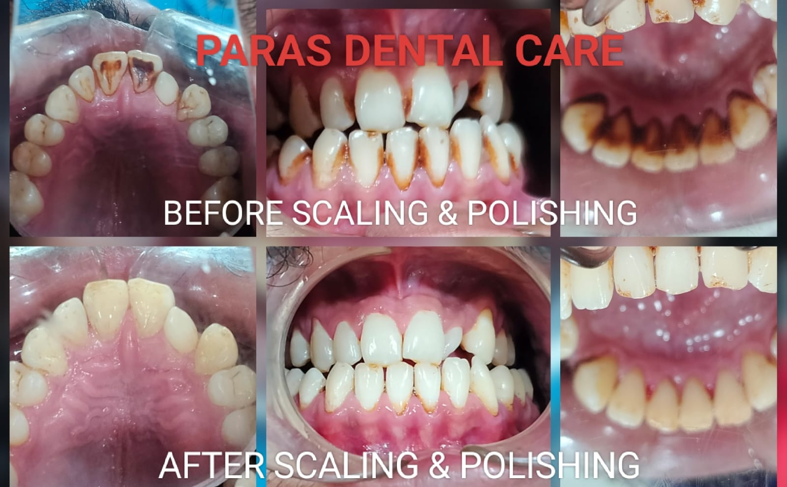 ⚡Achieving a Sparkling Smile With Paras Dental ... main image