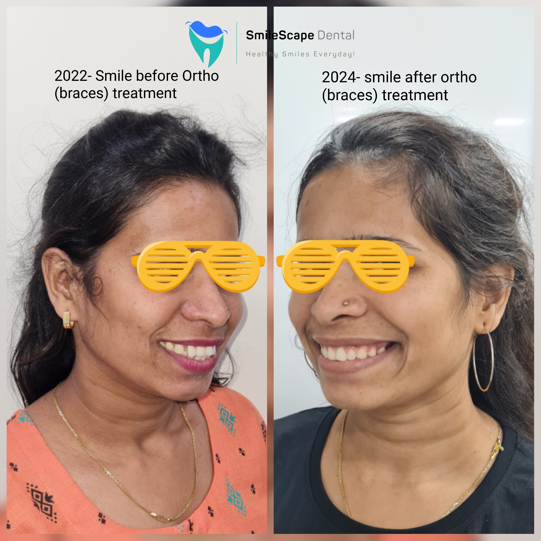 ORTHODONTIC (BRACES) TREATMENT and SMILE DESIGN... main image