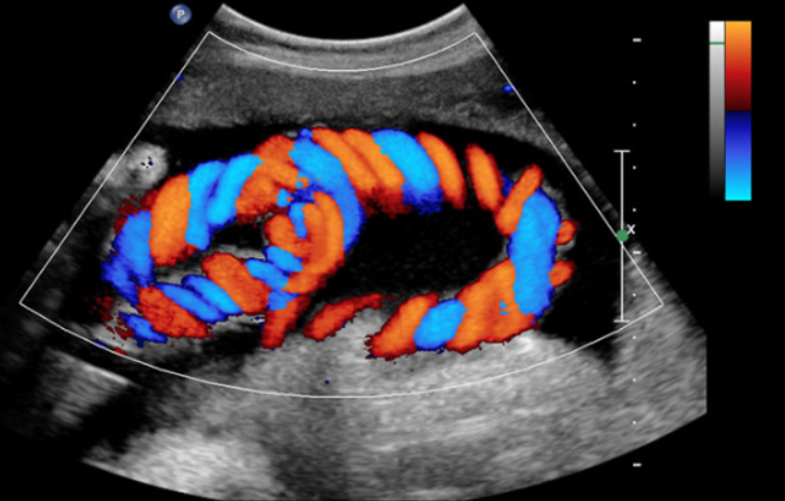 Color Doppler Servic