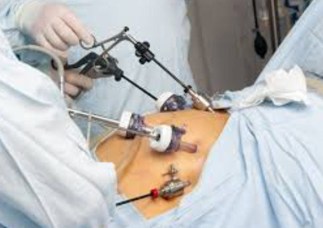 Top Bariatric Surgeon in Mumbai – Dr. Rajiv Man... main image