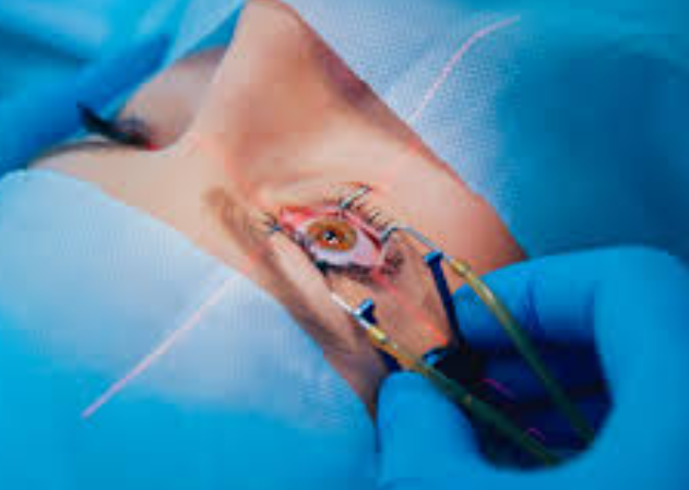 Cataract Treatment Surgery Isha Netralaya, Than... main image