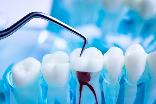 Full-mouth dental implants
Dental implants vs. ... main image