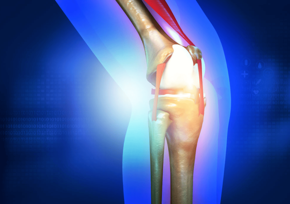 Expert Joint Replacement Surgery in Pune Advanc... main image