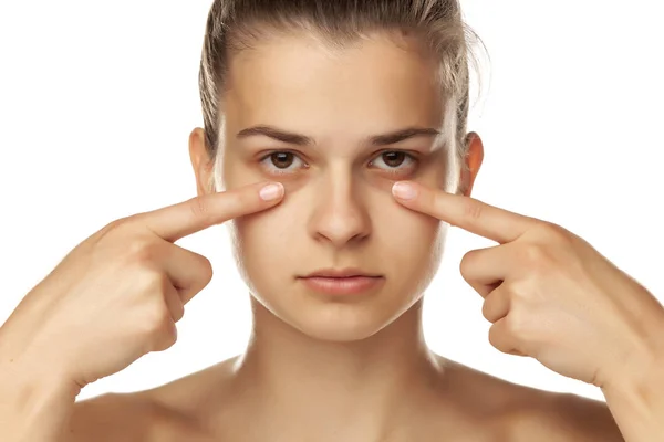 DARK CIRCLE TREATMENT AT ELORAA: Chemical Peels... main image