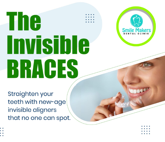 Best Invisalign Treatment in Pimple Saudagar | ... main image