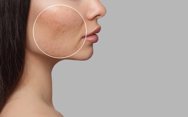 Best Skin Clinic in Bishop Garden and R.A. Puram -... main image