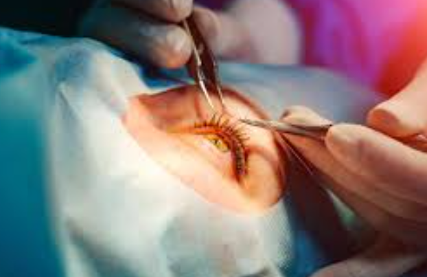 Cataract Treatment by Laser Isha Netralaya, Tha... main image