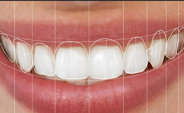 Best Smile Designing in Nagpur Achieve Your Dream ... main image
