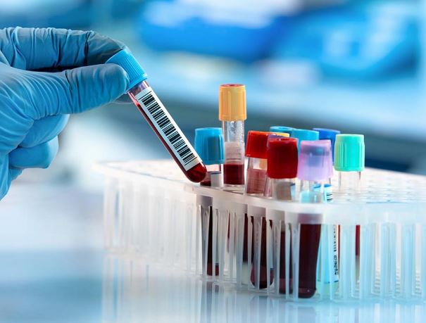 Superior Diagnostic Services at Ojas Multispeci... main image