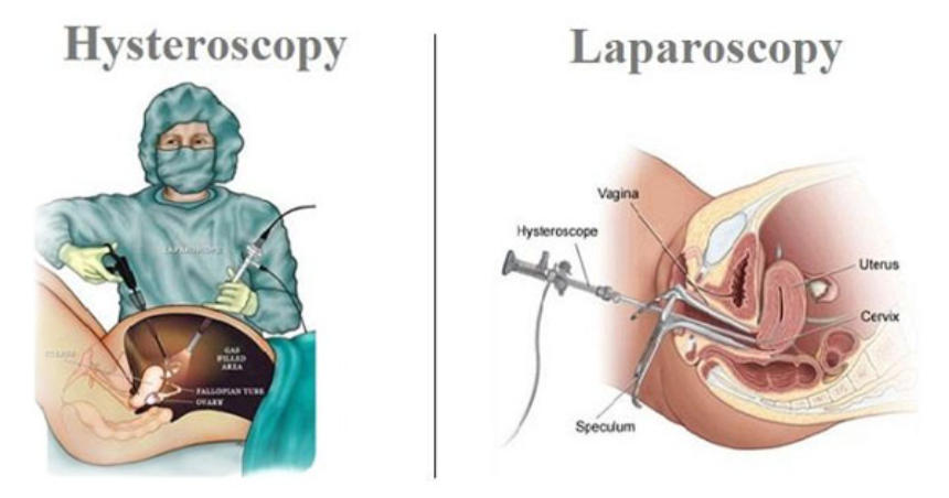 Laparoscopic and Hysteroscopic Surgery at Deepa... main image