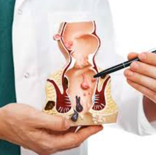 Expert Piles Surgeon in Bhayandar Dr. Rajiv Man... main image