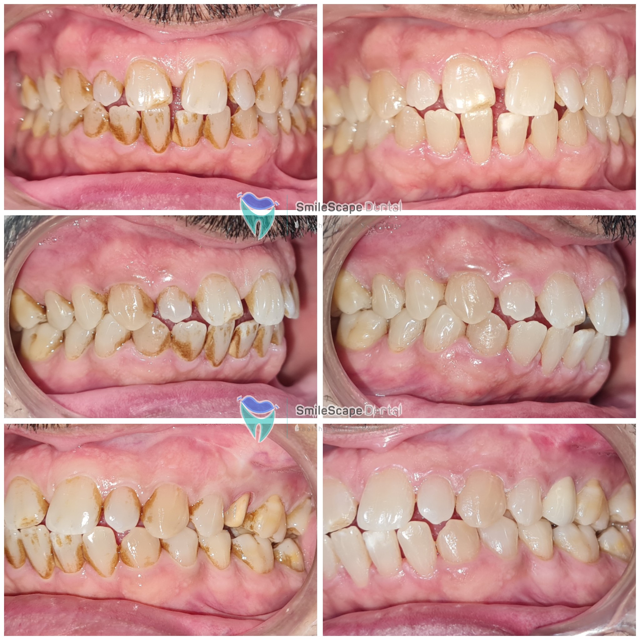 Who likes stained and dirty teeth? Who likes ba... main image