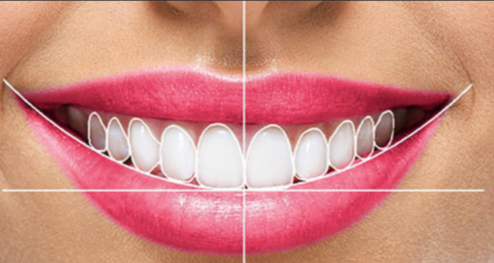 Best Smile Designing in Nagpur | Mogre Children Ho... main image