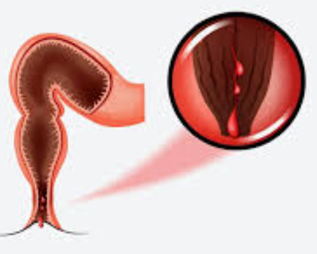 Fissure Surgeon in Bhayandar Dr. Rajiv Manek Dr... main image