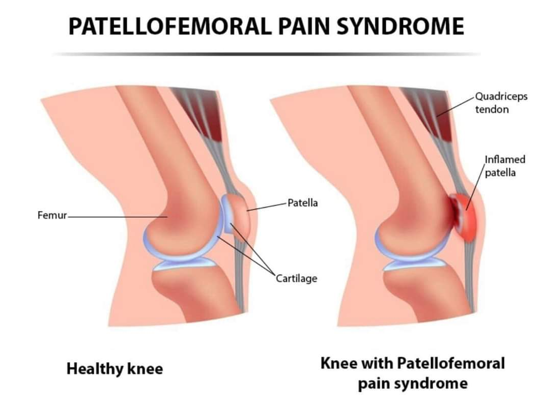 Physiotherapy clinic in Tambaram
Are you Looking f... main image
